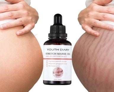 Cream with oil anti-stretch marks